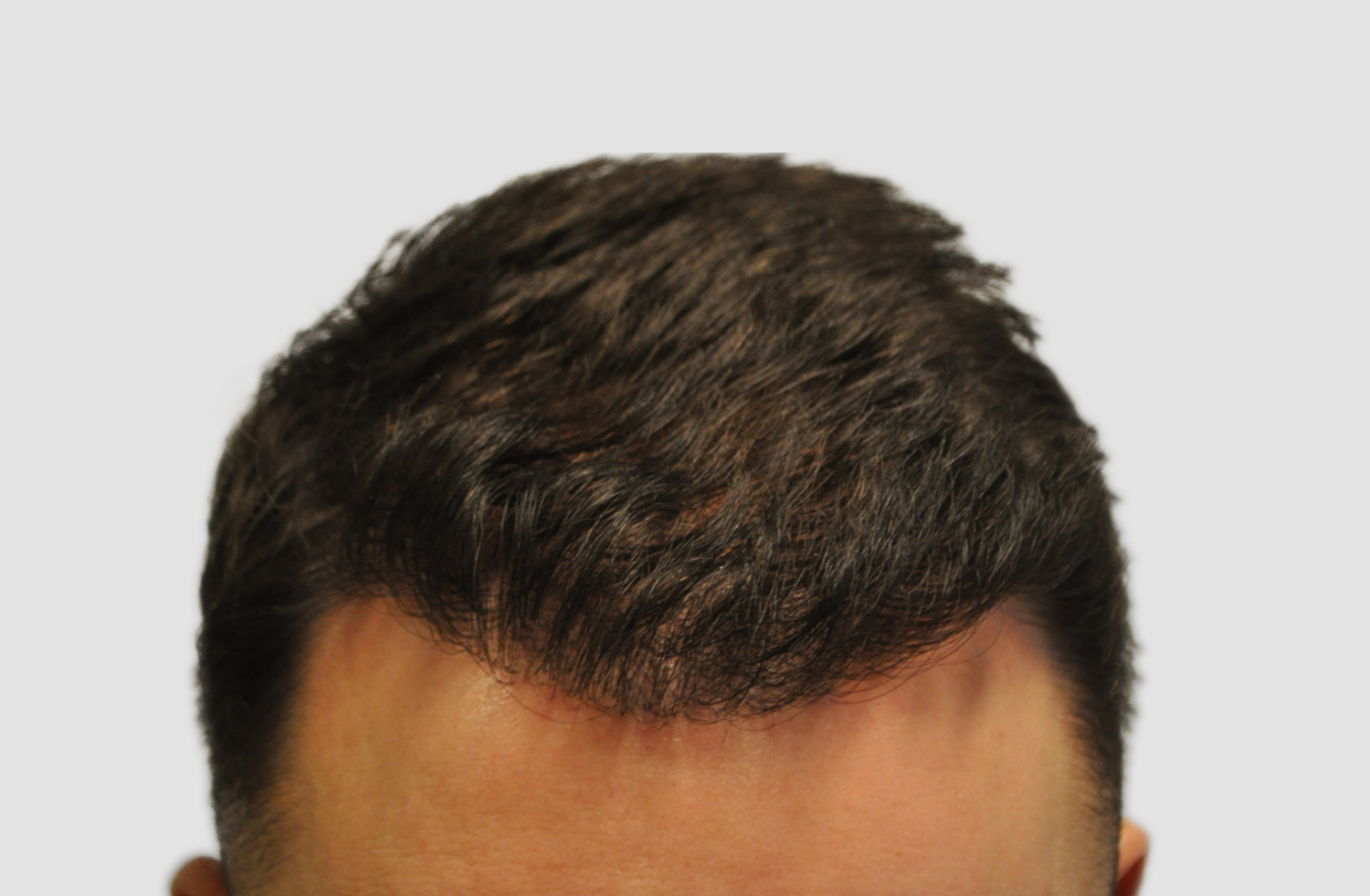 After