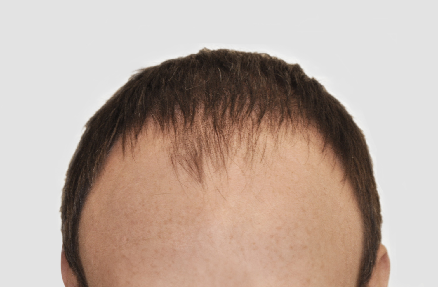 Before