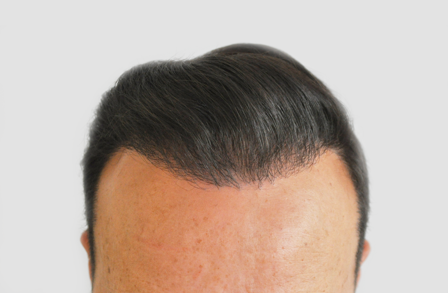 After