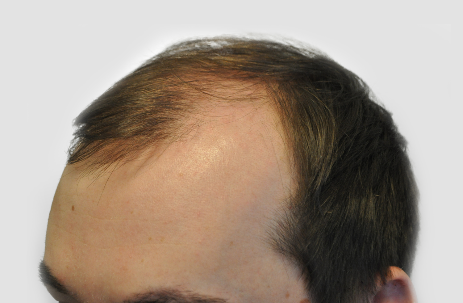 Before