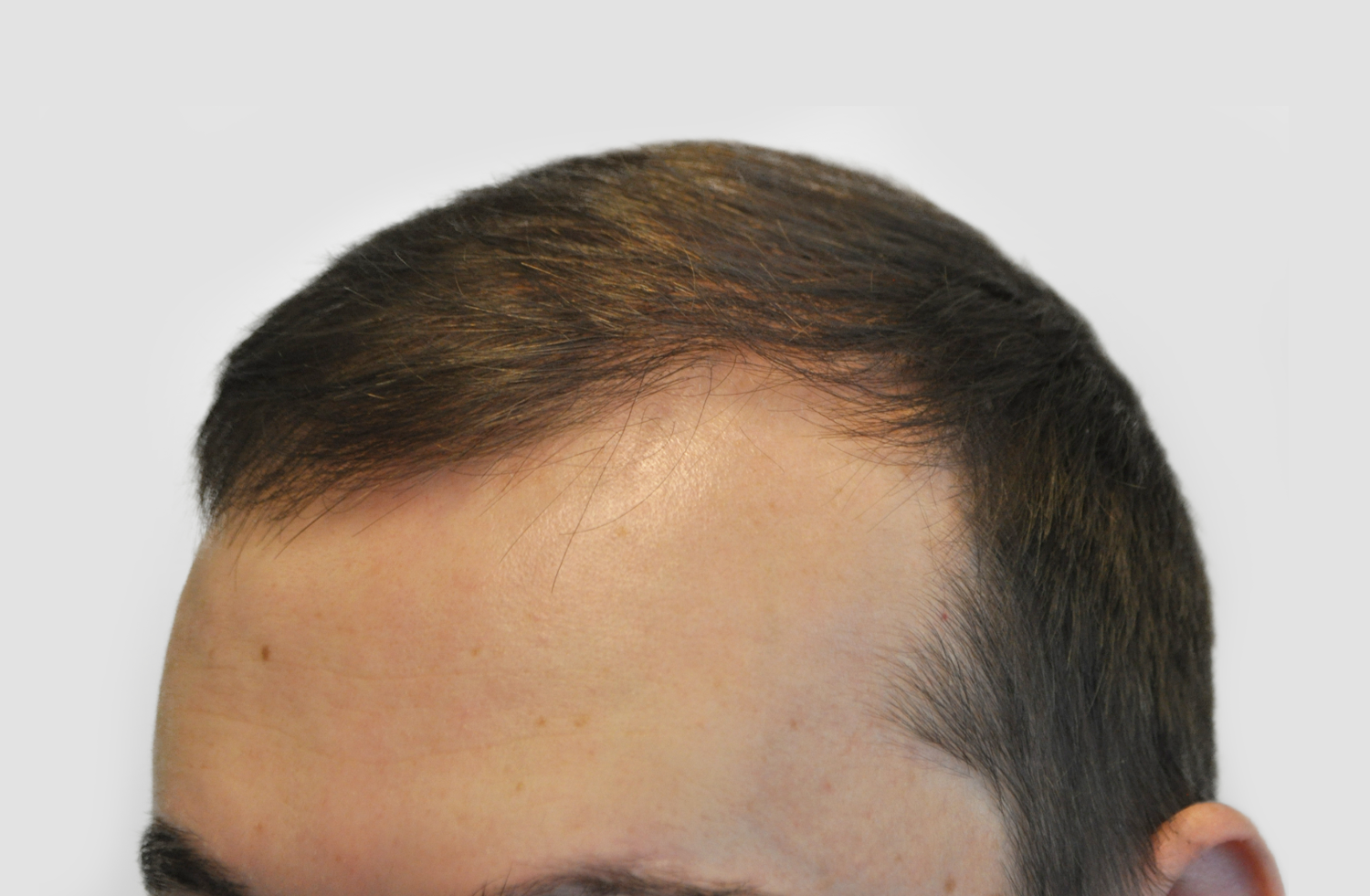 After