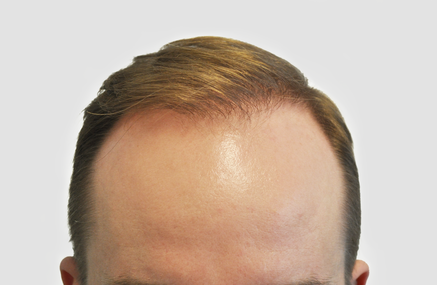 After