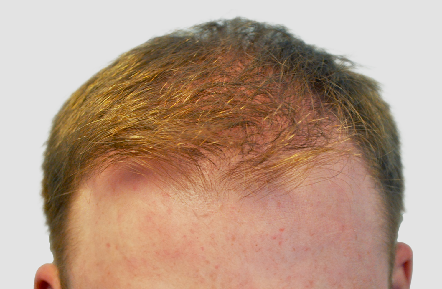 After