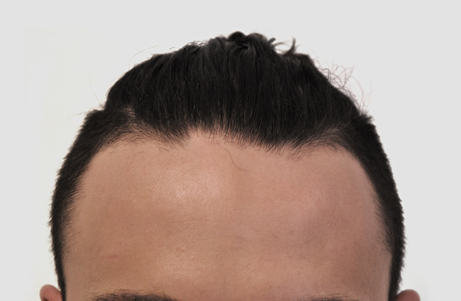 Before