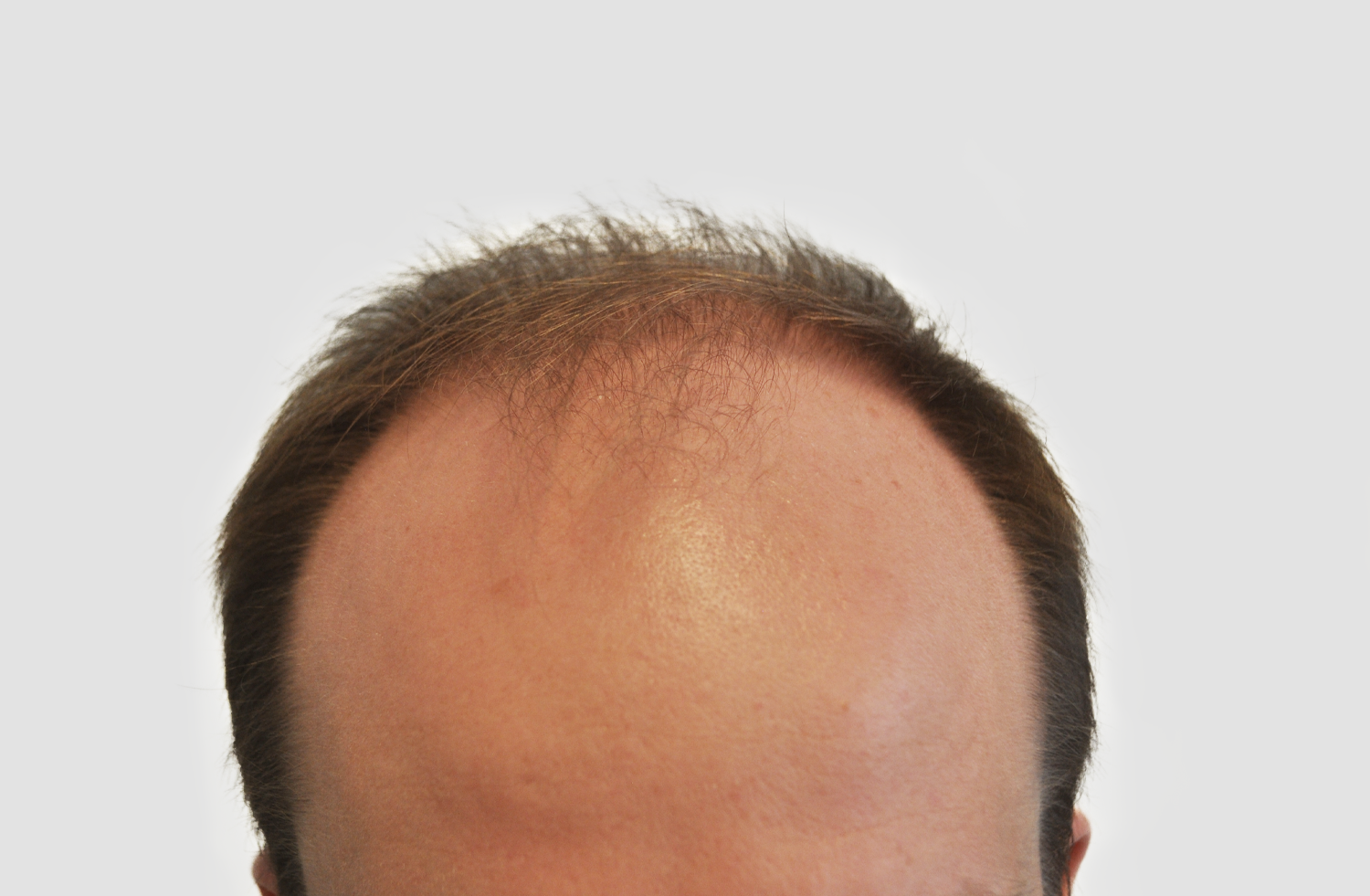 Before