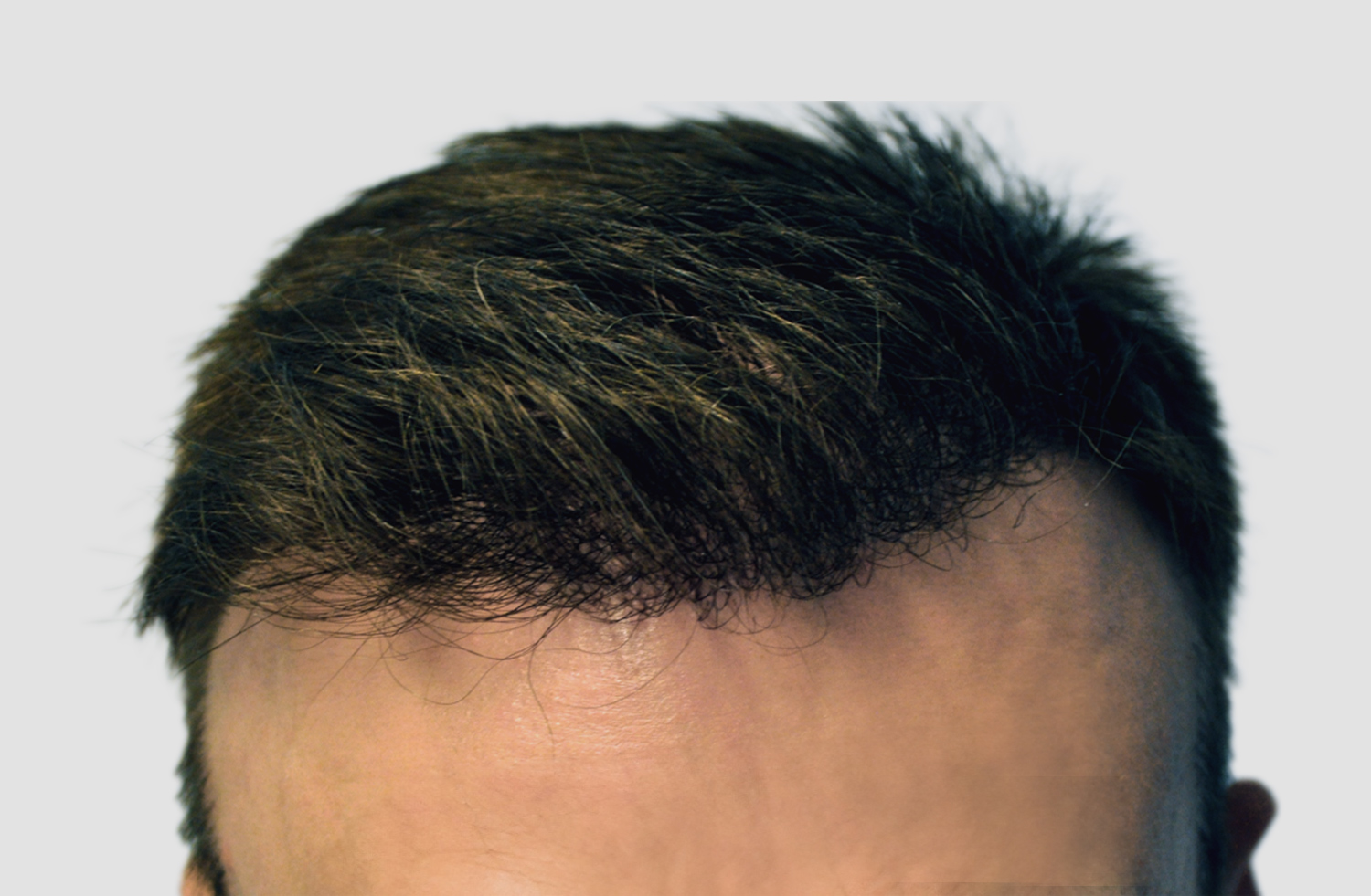 After