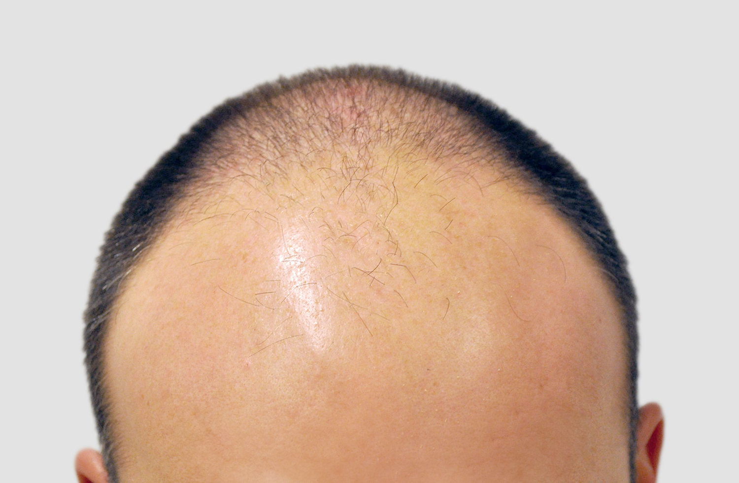 Before