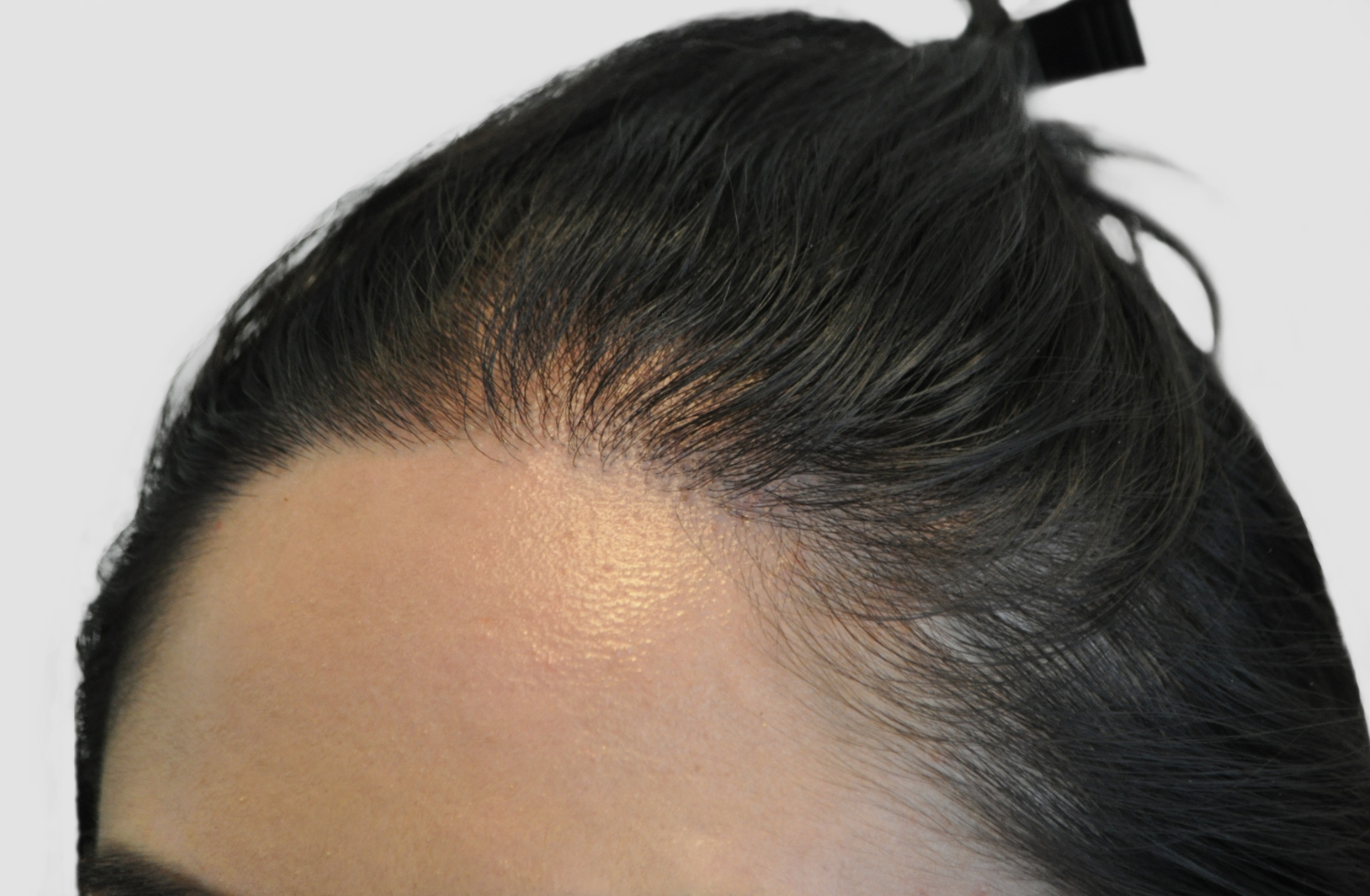 After