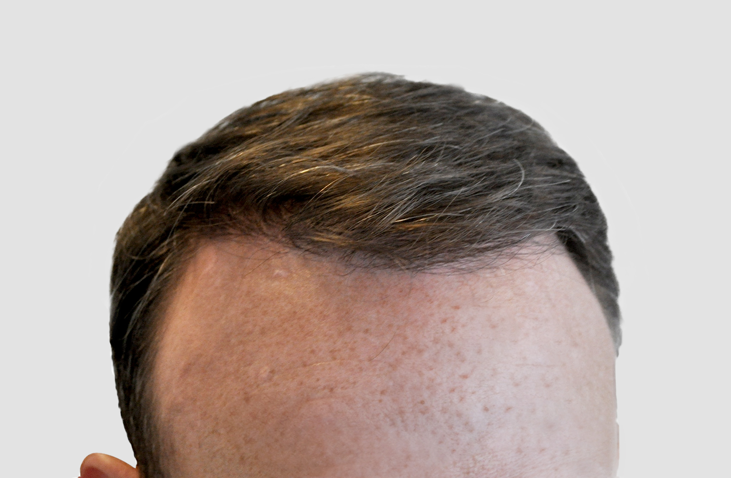 After